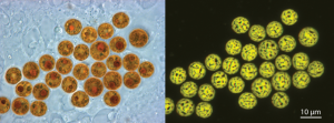 "Symbiodinium cells" by Allisonmlewis-Own work/ CC BY-SA 4.0